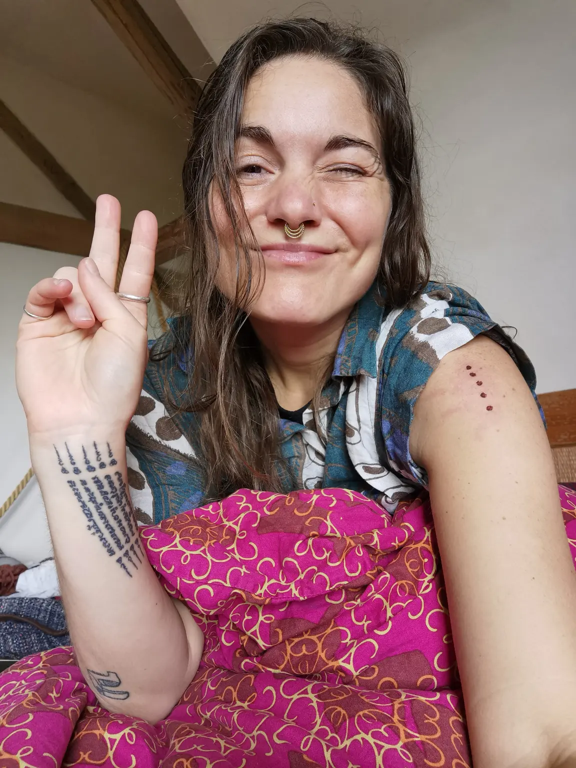 Anne lacht en maakt een vredesteken, met Kambo punten op haar arm
